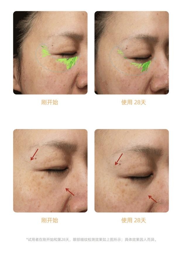 远离“抗老”焦虑，绽媄娅4维淡纹系列就是你要的“低调学霸”