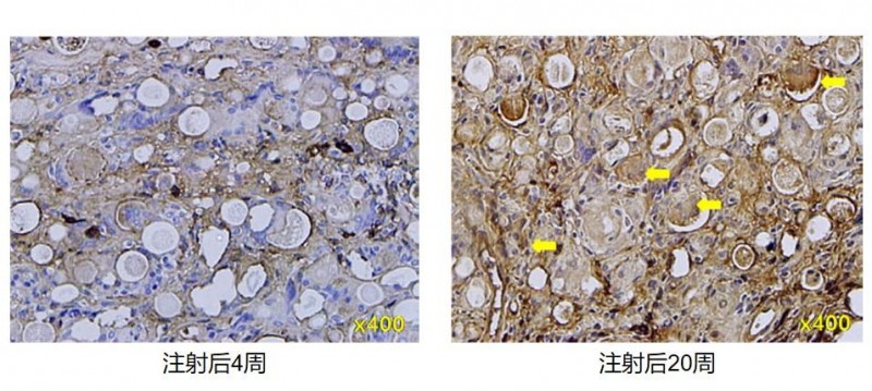 童颜针差异化第二弹：重返年轻态的路上，安全性尤为重要