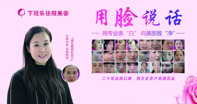 下班乐：秉承“客户至上”之理念，开创祛斑行业崭新篇章
