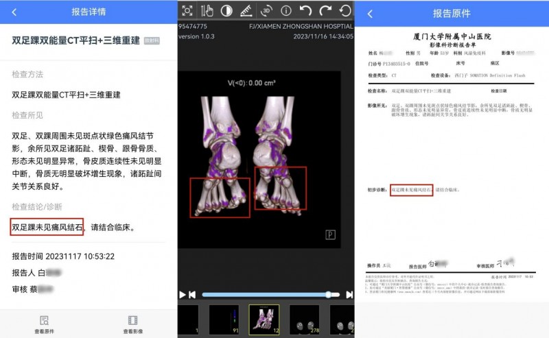 冯氏御风堂：传承苗药古方智慧，攻克痛风风湿难题