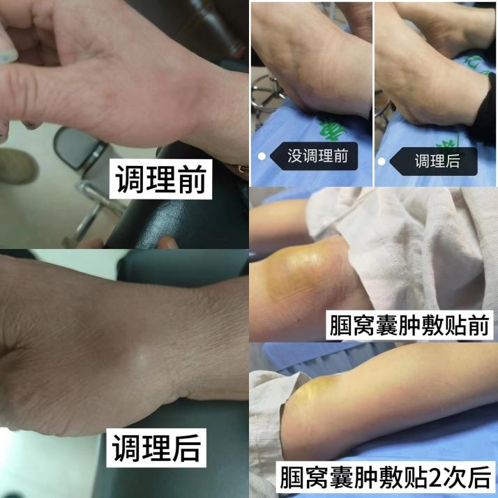 传承古方,创新未来,亿隆本草康膏药书写中医药发展新篇章