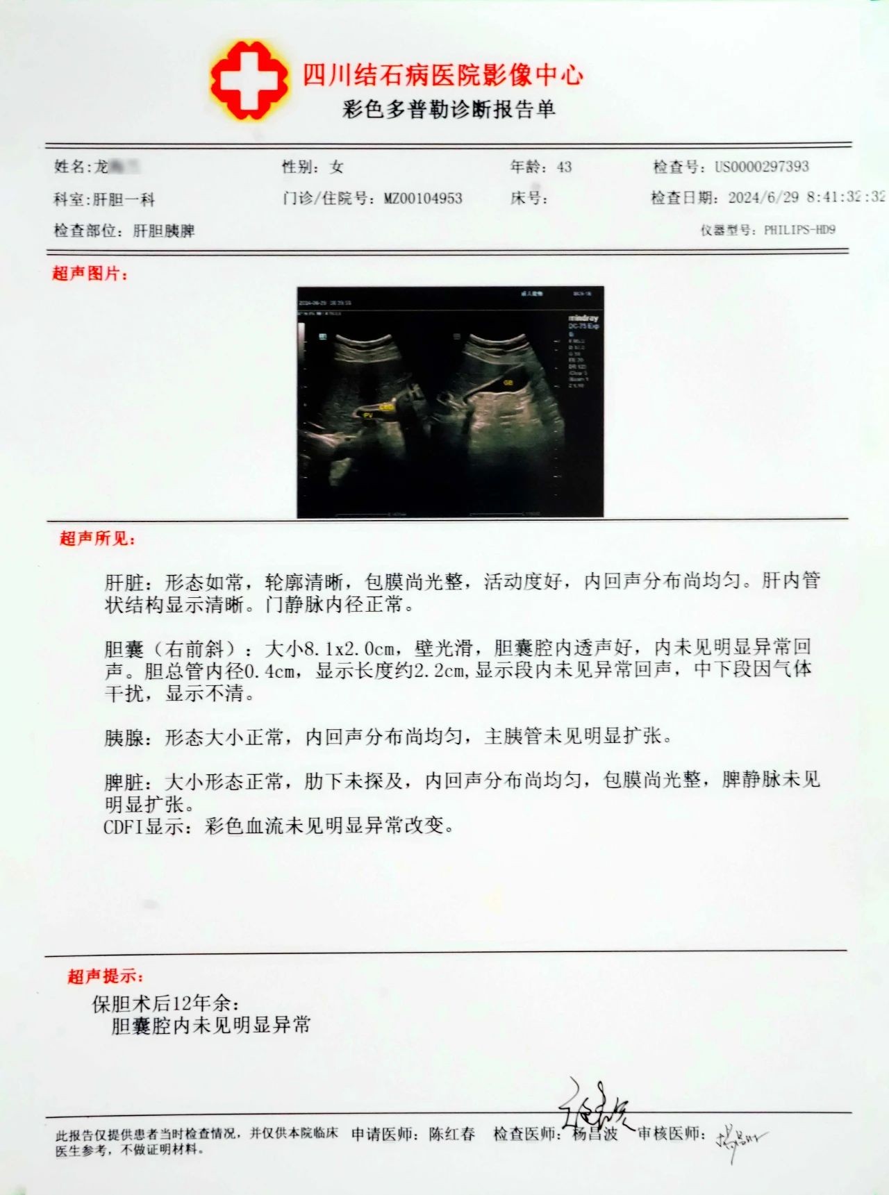 四川结石病医院对话保胆者:保胆术后多年,他们返院复查时是这样说的......