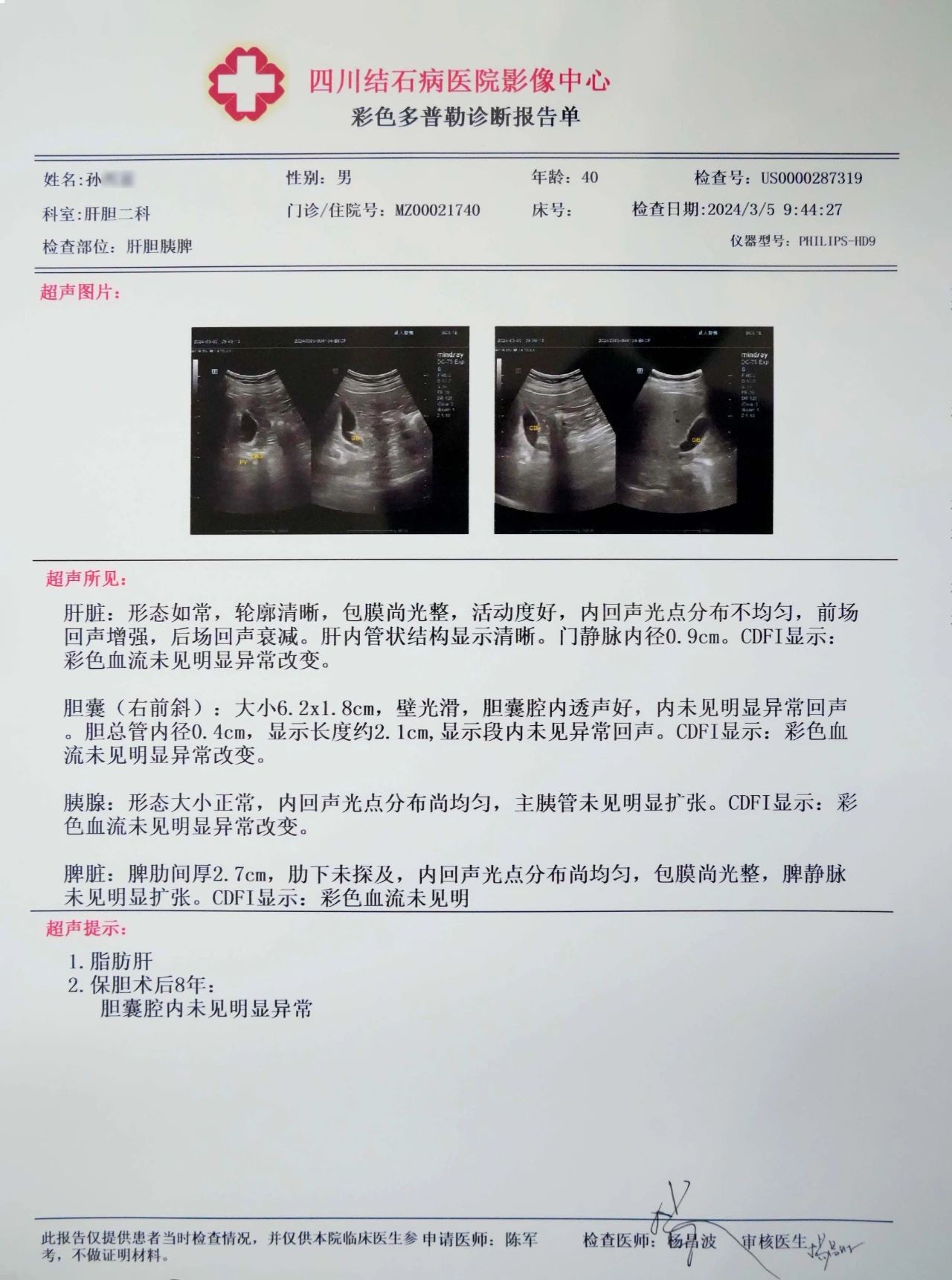 四川结石病医院对话保胆者:保胆术后多年,他们返院复查时是这样说的......