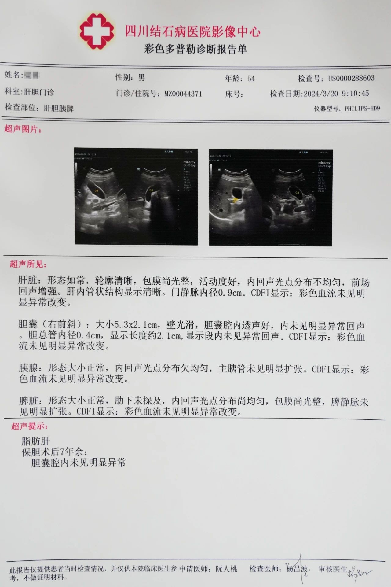 四川结石病医院对话保胆者:保胆术后多年,他们返院复查时是这样说的......