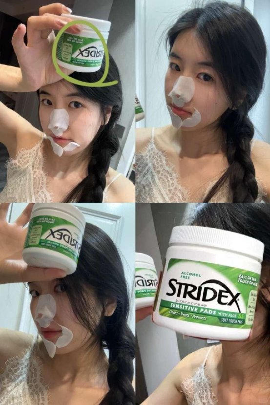 亲测有效！Stridex施颜适水杨酸棉片“磨皮”闭口粉刺