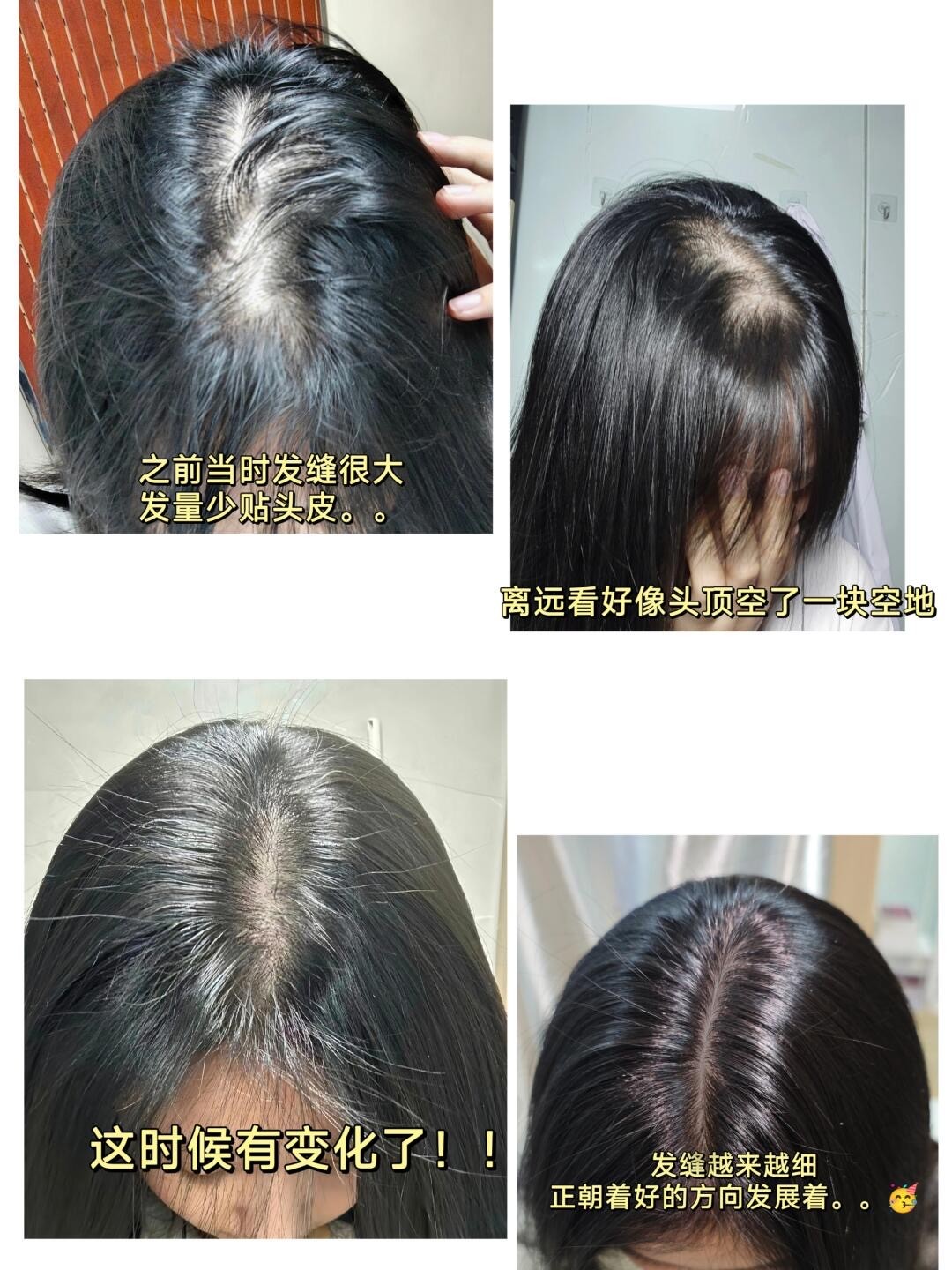 露卡菲娅防脱育发液：专利育发科技赋能，见证“秃”围！