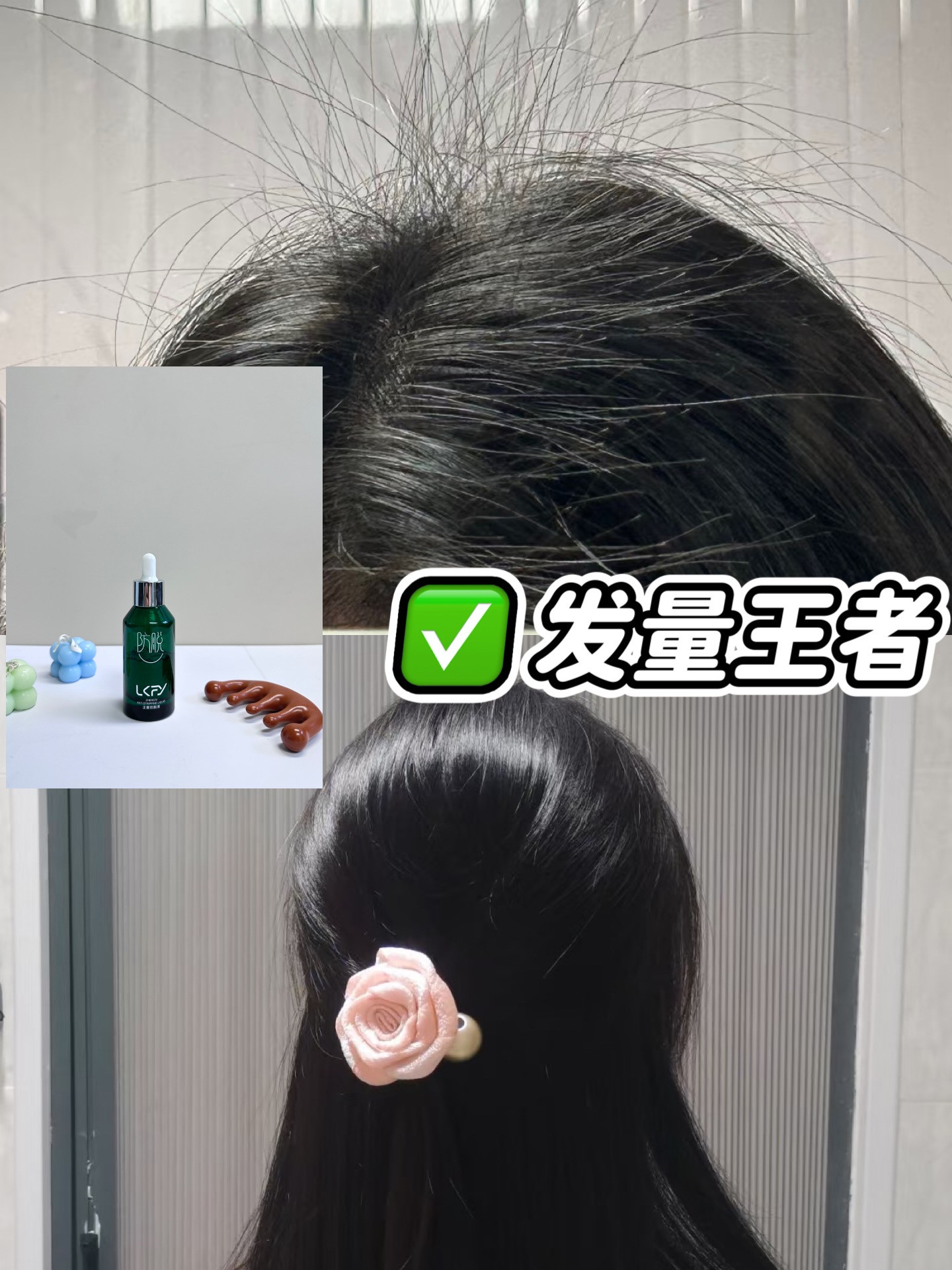 露卡菲娅防脱精华液：破解密发生发秘笈的理性之选！