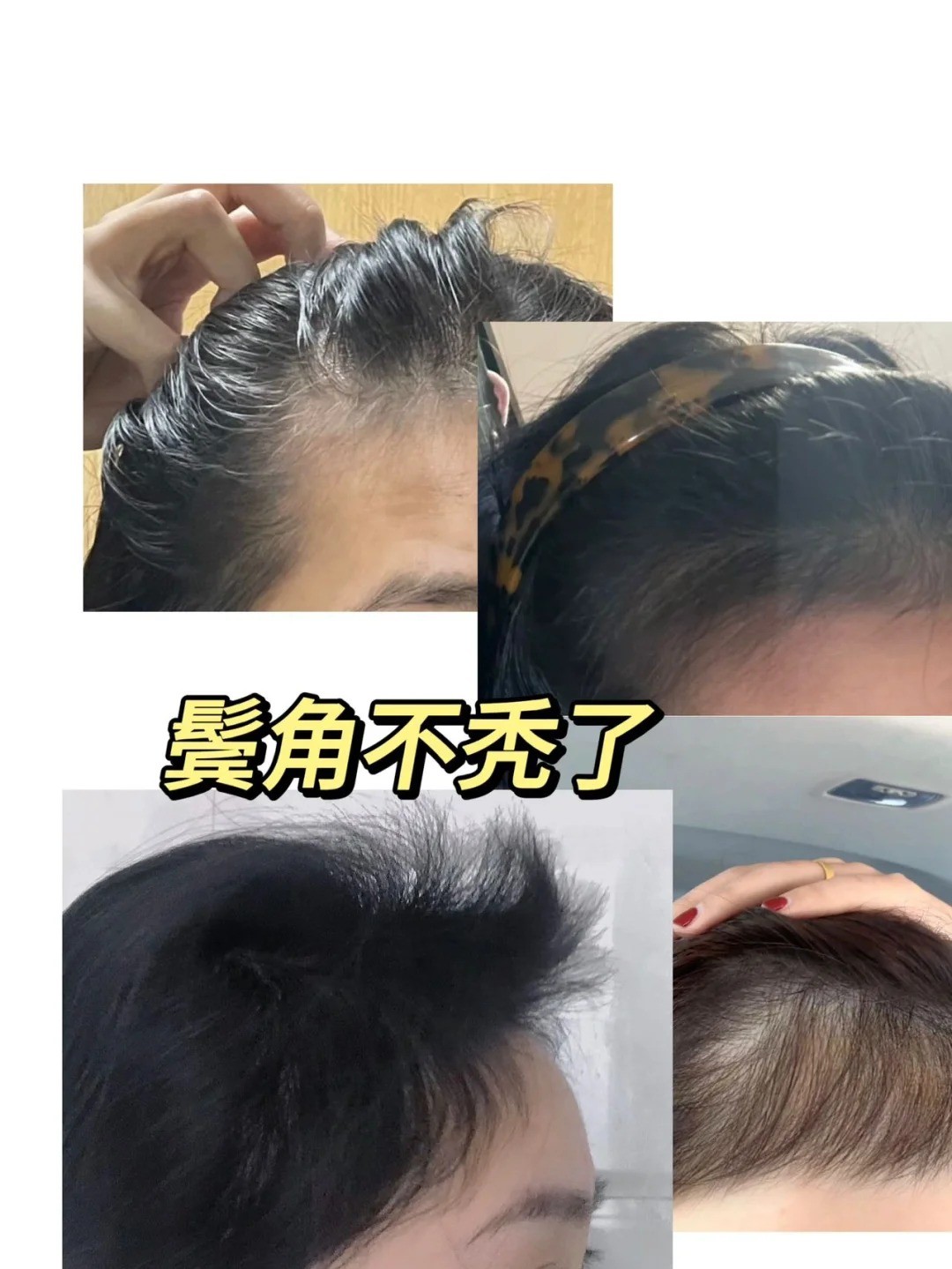 露卡菲娅防脱精华液，30天全周期育发路径，科学生发闭环！
