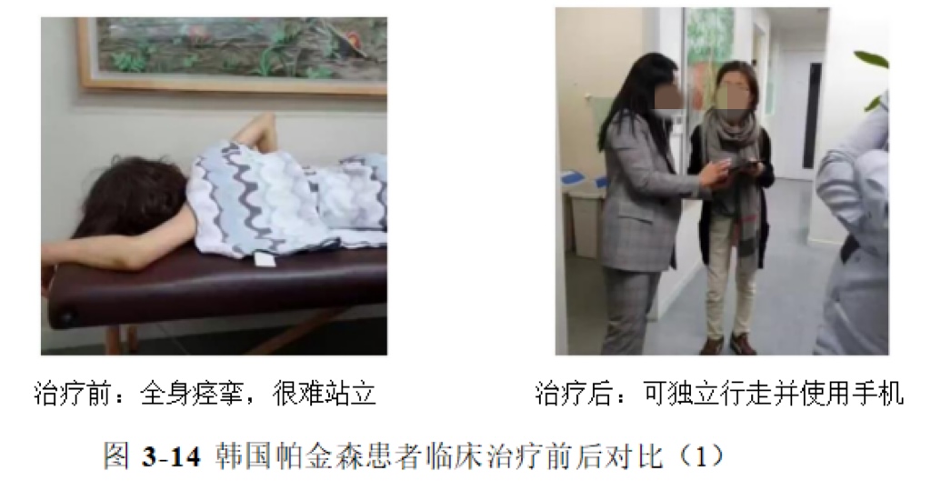 环球细胞库与长沙唯康医院共建秦正红院士工作站 开启帕金森病治疗新篇章——世界帕金森病日聚焦神经退行性疾病创新疗法