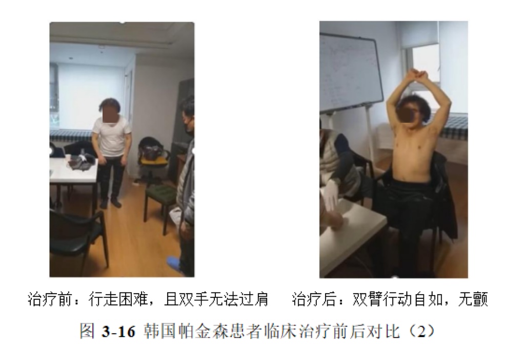 环球细胞库与长沙唯康医院共建秦正红院士工作站 开启帕金森病治疗新篇章——世界帕金森病日聚焦神经退行性疾病创新疗法