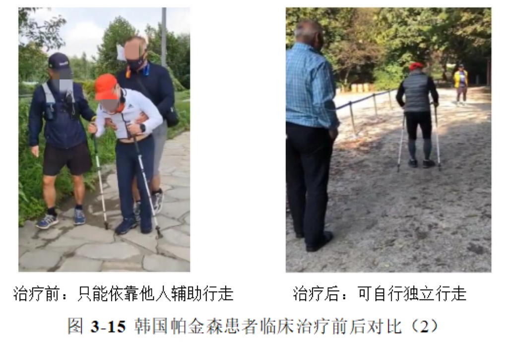 环球细胞库与长沙唯康医院共建秦正红院士工作站 开启帕金森病治疗新篇章——世界帕金森病日聚焦神经退行性疾病创新疗法