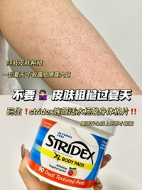 施颜适水杨酸棉片：春夏季鸡皮肤的救星